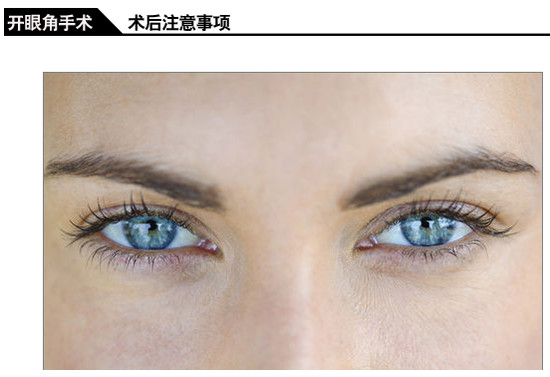 如何让眼睛快速出血 e75182eb7de41c73a2581aca848cdbb3.jpg